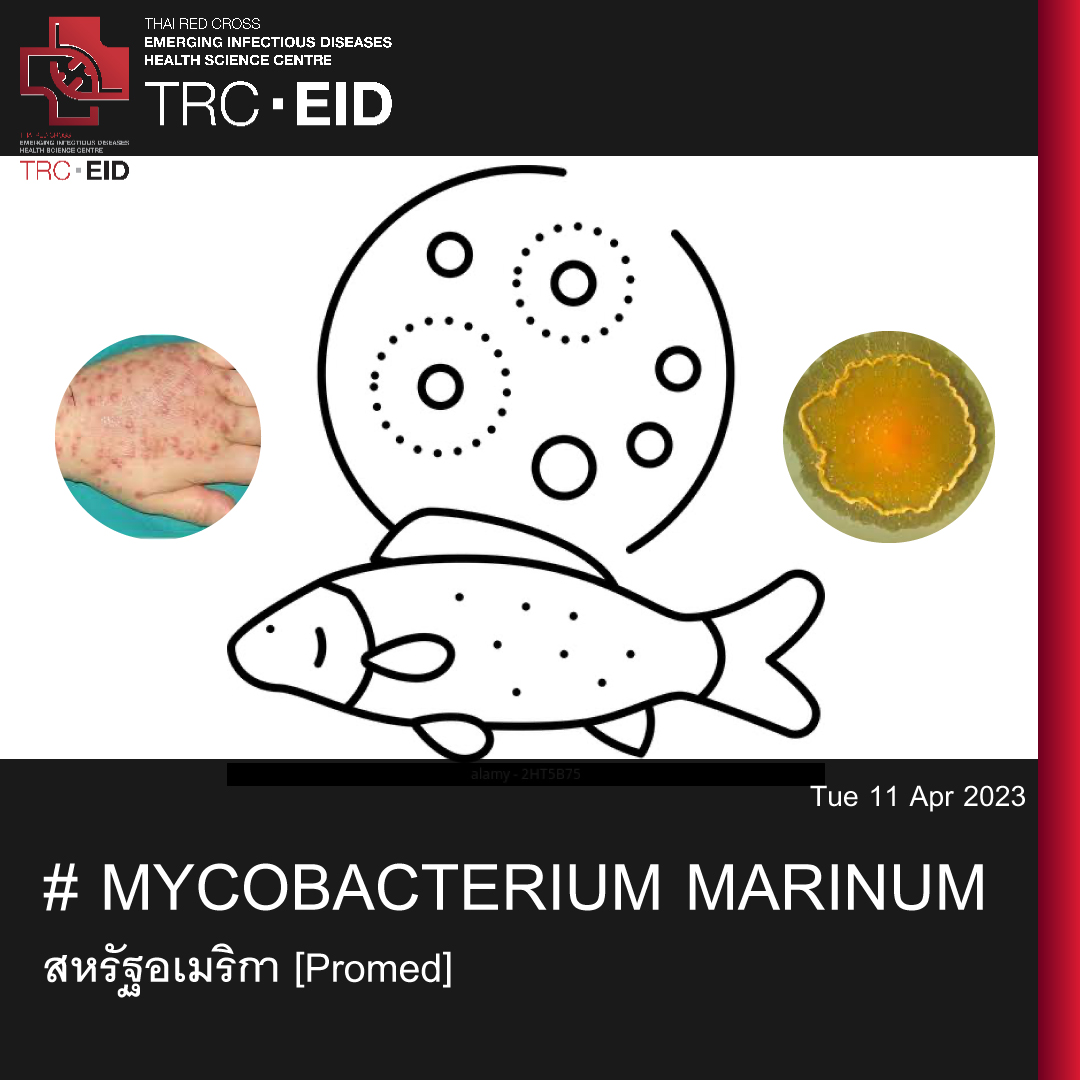 # MYCOBACTERIUM MARINUM – ​​สหรัฐอเมริกา [Promed]